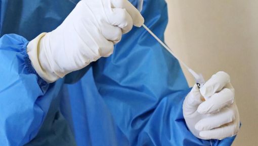 Hepatitis y viruela de mono: ¿surgen más enfermedades o ahora son detectadas?