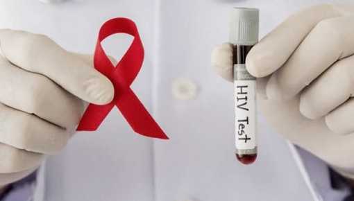¿Qué aporta la nueva Ley de VIH, tuberculosis, hepatitis e ITS?